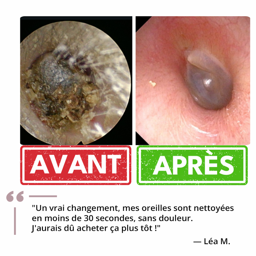 Système de Nettoyage Auriculaire™