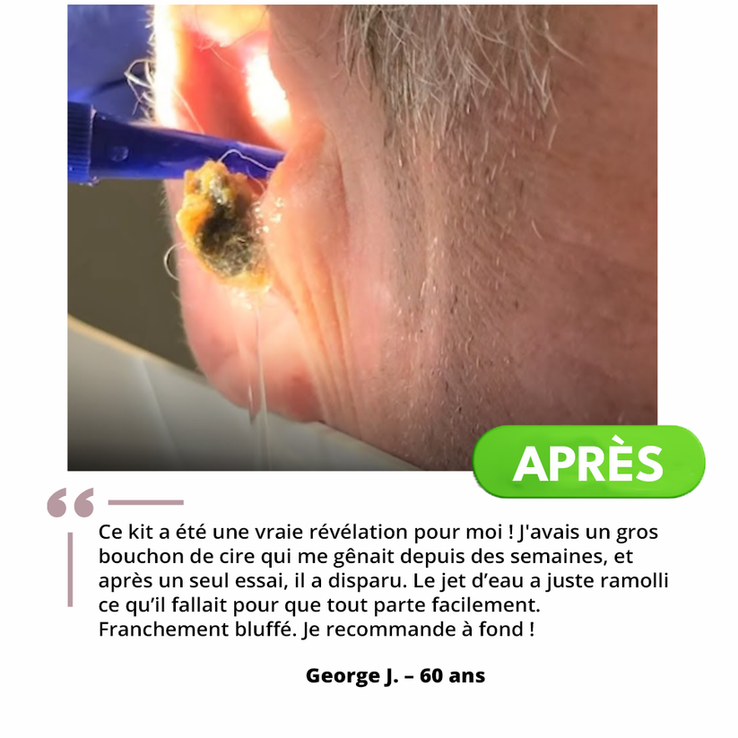 Système de Nettoyage Auriculaire™